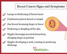 Image result for breast cance