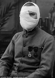 Image result for WWI Injuries