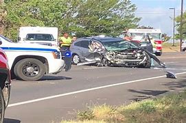 Image result for Fatal Car Crash Injuries