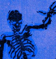 Image result for Skeleton On Ground