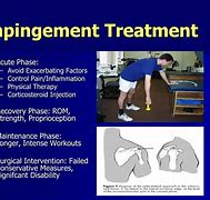 Image result for Physical Therapy for Shoulder Impingement