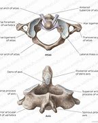 Image result for Atlas Vertebrae