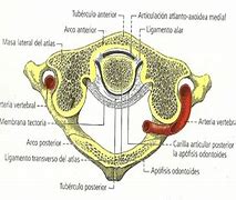 axoideo 的图像结果