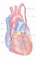 Image result for Coronary Artery Bypass Graft Model