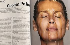 Image result for Palm Oil Allergy Symptoms