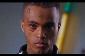 Image result for Xxxtentacion Hope Song
