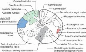 Image result for Labeled Slide of the Closed Medulla