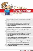 Image result for Instructions After Tooth Extraction