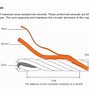 Image result for Wire Rope Termination Types