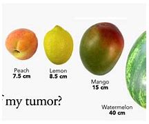 Image result for How Big Is 12 Cm Tumor