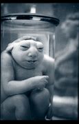 Image result for Anencephalic Baby Corpse Mummy