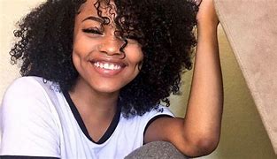 Image result for What Causes Dimples
