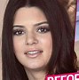 Image result for Kendall Jenner Nose Job