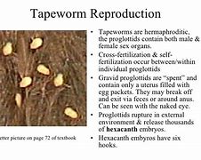 Image result for Tapeworm Eggs in Human Poop