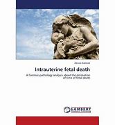 Image result for Intrauterine Fetal Death Ostium