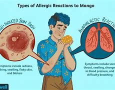 Image result for Mango Allergy Baby
