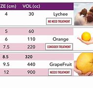 Image result for Liver Cyst Size Chart