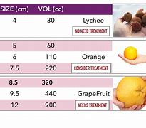 Image result for Ovary Cyst Size Chart