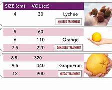 Image result for 10 Cm Ovarian Cyst