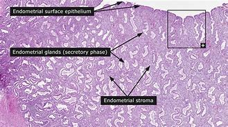Image result for Endometrium Functional Layer