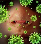 Image result for infecxioso
