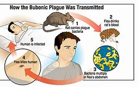 Image result for Bubonic Plague Lymph Nodes