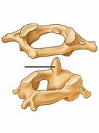 Image result for Atlas and Axis Vertebrae