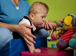 Image result for Cerebral Palsy Treatment