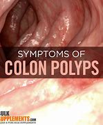 Image result for Small Colon Polyp