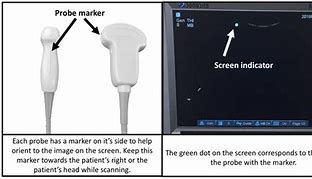 Image result for Ultrasound Screen Orientation