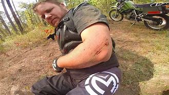 Image result for Broken Arm On Motorcycle