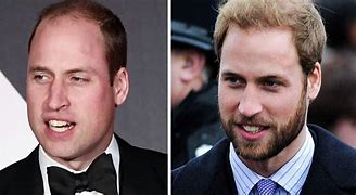 Image result for Royals with Beards