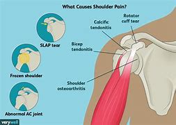 Image result for Sharp Pain in Neck Shoulder