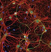 Image result for 3D Brain Neuron