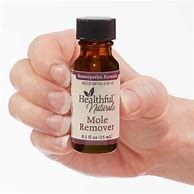 Image result for H Mole Remover