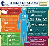 Image result for Stroke Patient Recovery