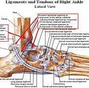 Image result for Foot Tendons