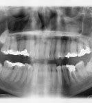 Image result for Dental X-Ray Refusal Form
