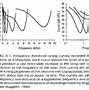 Image result for Psychoacoustic Tuning Curve