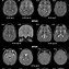 Image result for Human Brain Scan