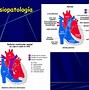 Image result for ecg cia