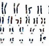 Image result for chromosom_3