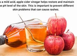 Image result for Someone's Apple Cider Vinegar Allergy Look Like