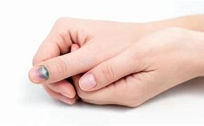 Image result for Bruised Pinky Finger