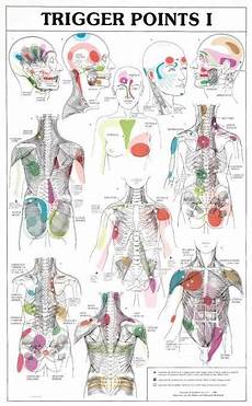 Trigger Points Chart Referred Pinterest