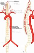 Image result for Radicular Artery