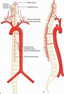 Image result for Vertebral Artery Blood Supply