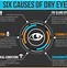 Image result for Dry Eye Disease