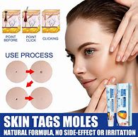 Image result for Kulugo Removal Cream