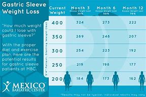 Image result for Gastric Sleeve Weight Loss Chart